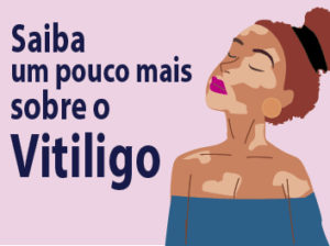 Leia mais sobre o artigo Saiba um pouco mais sobre o Vitiligo