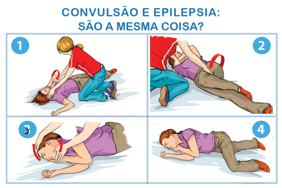 Você está visualizando atualmente CONVULSÃO E EPILEPSIA: SÃO A MESMA COISA?